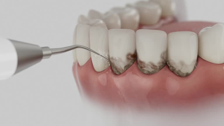 Trusted Emergency Dentist service in Riverton, UT - Dentist Open Now